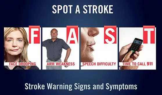 How to spot a stroke using FAST