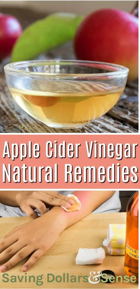 apple cider vinegar uses