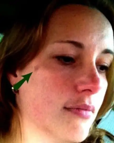 A woman looking down and featuring a small mole on the side of her face.
